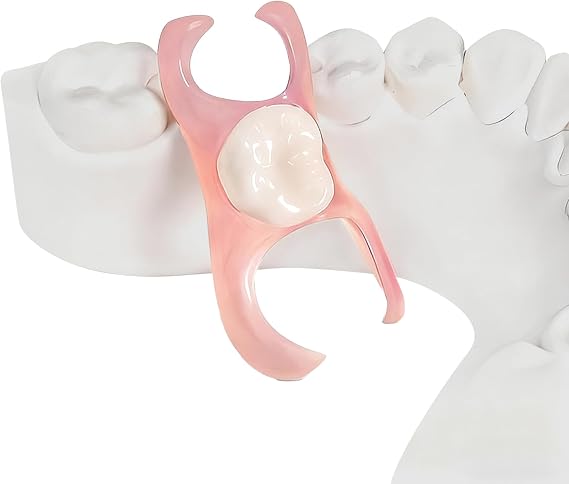 Partial Dentures (1 Tooth)
