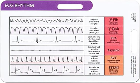 EKG Rhythm Interpretation, Compact Reference Card Badge Buddy & Pocket Rapid Interpretation Guide with Horizontal & Vertical Layout Cheat Sheet for Nurses, Paramedics, Medical Students A
