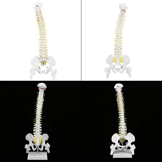 Spine Model with Removable Limbs and Metal Frame