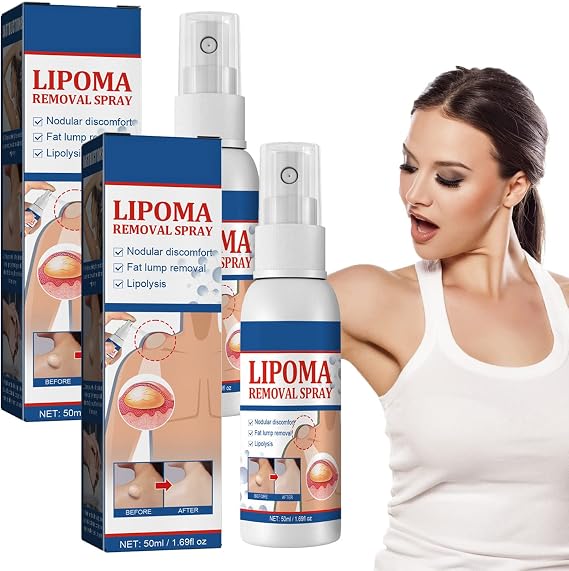LipoOut Lipomheilung Reduction Spray, Instant LumpFree Lipoma Removal Spray, LumpFree Lipoma Removal Spray 50ml (2pcs)