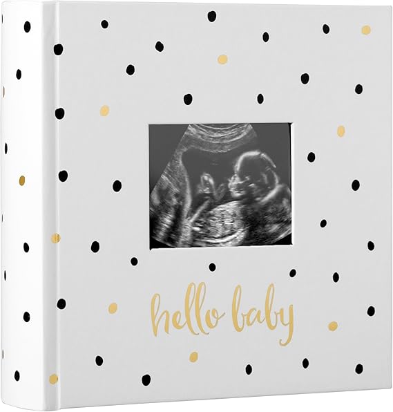 Pearhead Hello Baby Fotoğraf Albümü, Yeni ve Bekleyen Ebeveynler için Bebek Kitabı Hatırası, Cinsiyetsiz Bebek Aksesuarı, 200 Fotoğraf Tutar, Siyah ve Altın Puantiyeli