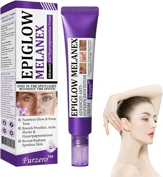Ceoertys EPIGLOW MelanEX Advanced Anti-Hyperpigmentation Cream, Dark Spot Cream For Hyperpigmentation Treatment, Anti Aging Face Cream, Dark Spot Remover 20g (1)