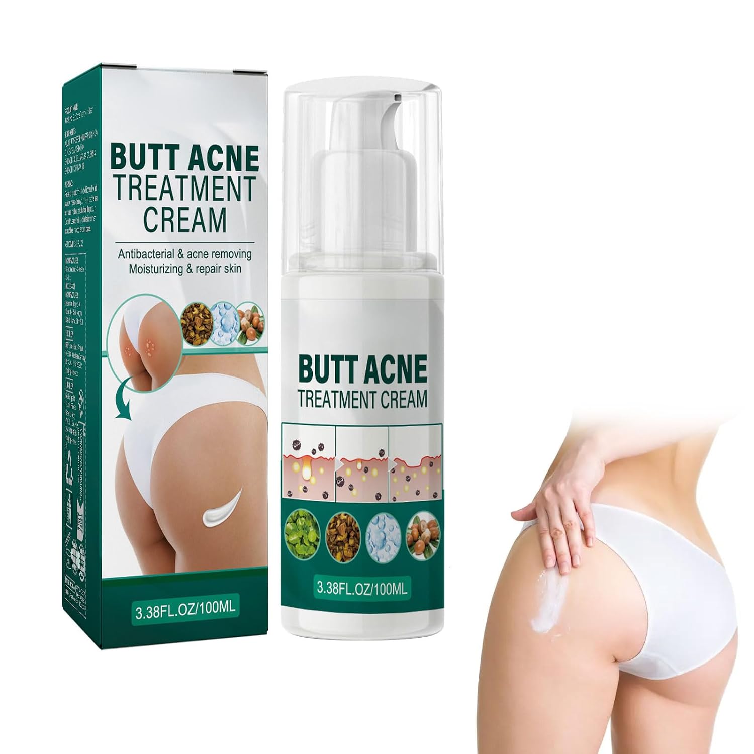 Hip acne cream butt acne cream acne remover on the buttocks acne cleansing cream for removing blackheads on the buttocks butt acne treatment cream for the treatment of glutegrains