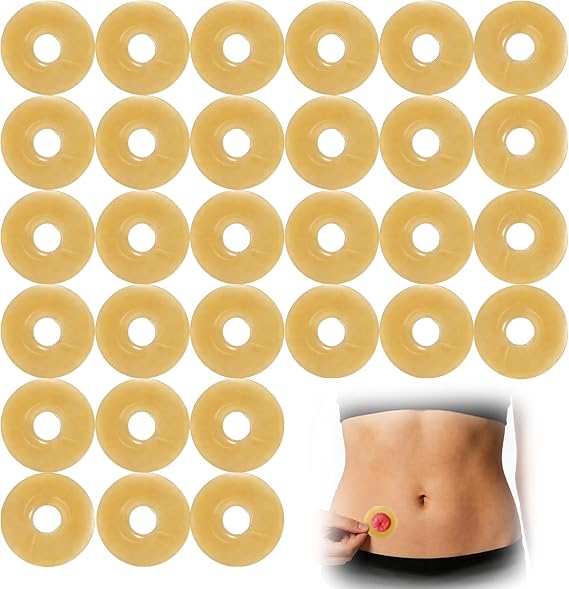 Ostomy Barrier Rings,Elastic Hydrocolloid Tape Cohesive Seals,Moldable Ostomy Ring,Moldable Skin Extender,Stoma Protector Seal,Ostomy Supplies for Colostomy,Ileostomy & Urostomy Bags (30)