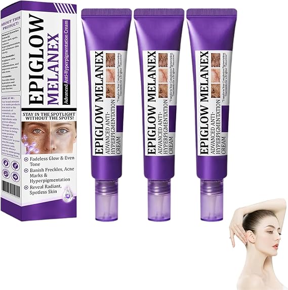 Ceoerty EPIGLOW MelanEX Advanced Anti-Hyperpigmentation Cream, EPIGLOW MelanEX Cream for Hyperpigmentation Treatment, Dark Spot and Anti-Ageing Face Treatment, for All Type Skin (3Pcs, 1)