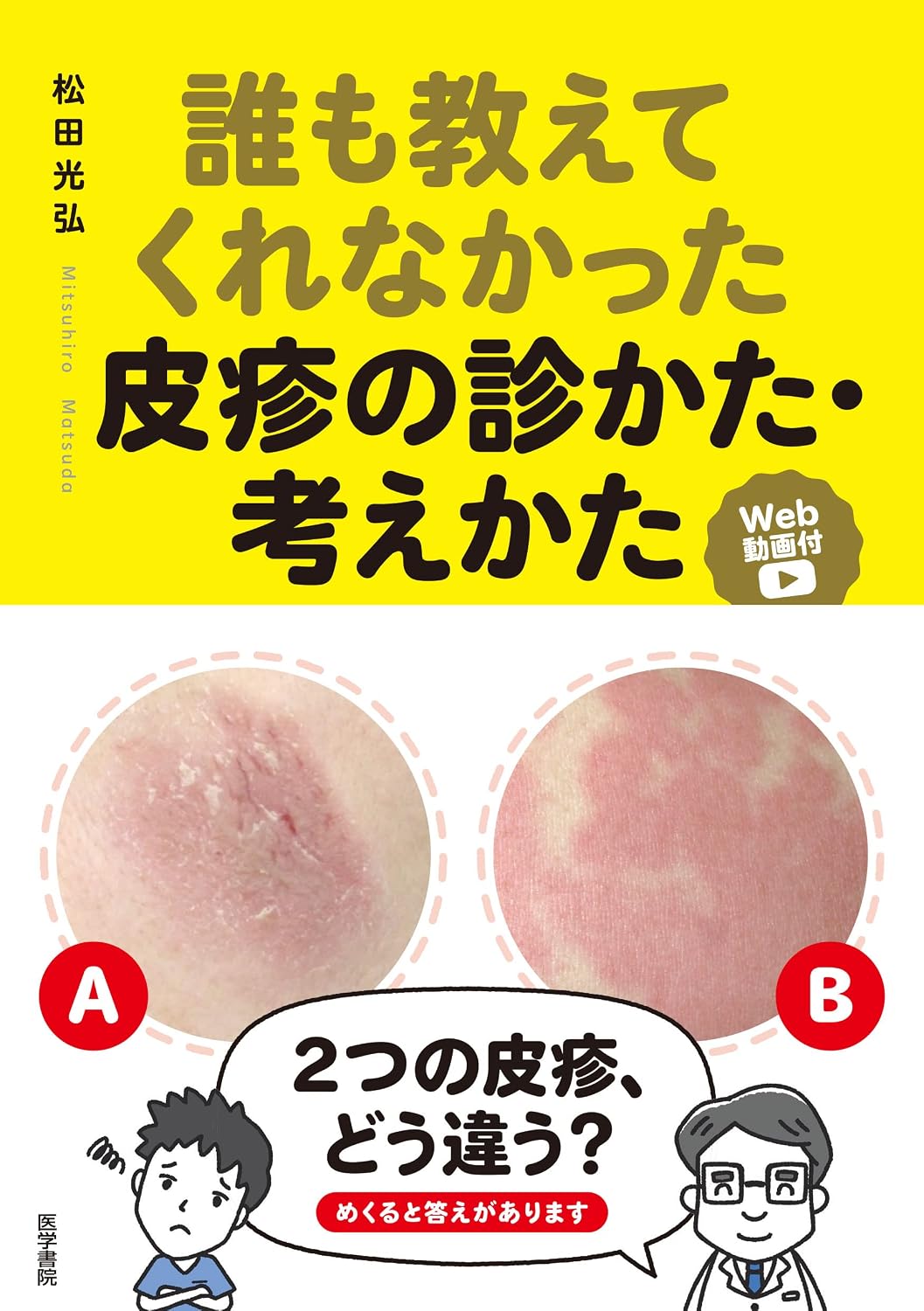 Tankobon Hardcover – December 27, 2021 with web video on how to treat and think about skin rash that no one told me about